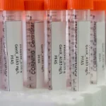 Belgium Accused of PFAS Human Rights Violation Over Toxic Pollution